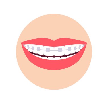 Diş tellerinde ortodonti.