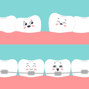 Ortodontik tedavi kavramı. Öncesinde dişleri dökülmüş, sonrasında diş telleri. Vektör illüstrasyonu