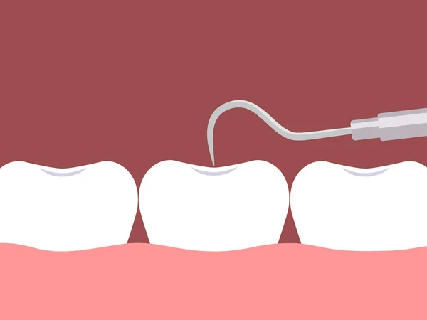 Controllo Dente Parte Esploratore Dentale Illustrazione Vettoriale — Vettoriale Stock