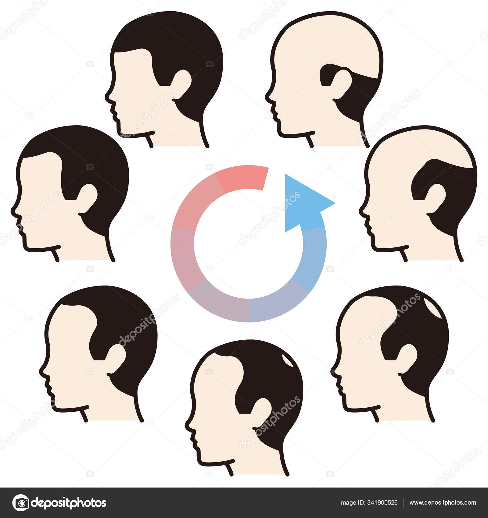 Information chart of hair loss stages and types of baldness illu Stock