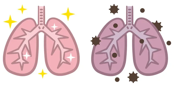 Infección Por Neumonía Concepto Médico Como Pulmones Humanos Infectados Por — Archivo Imágenes Vectoriales