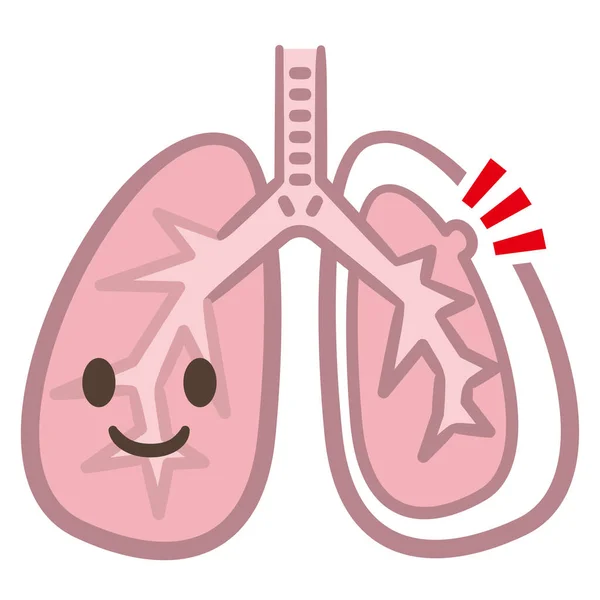 Symptomy Pneumothorax Plicní Vektor — Stockový vektor