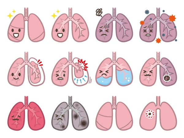 Bir Dizi Akciğer Hastalığı Çizimleri — Stok Vektör