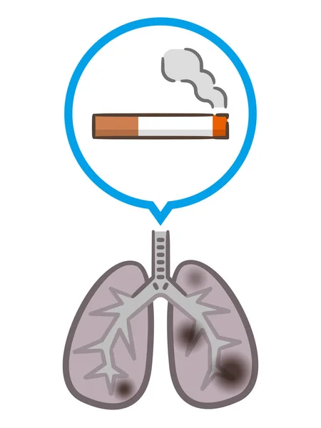 Sigarettenrook Longen Sigaret Vernietigt Longen Witte Achtergrond — Stockvector