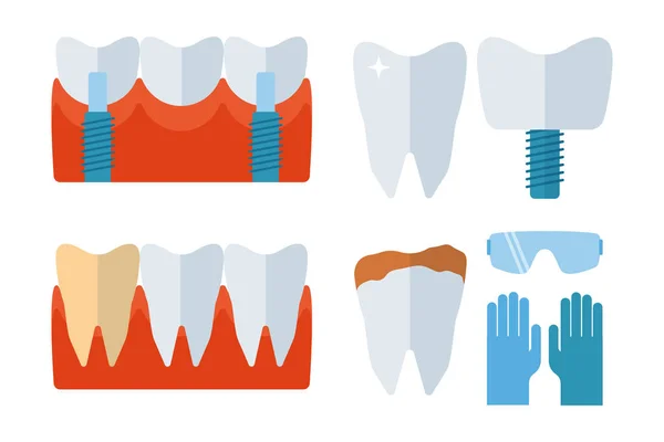 Dentiste implants dentaires et matériel de stomatologie illustration vectorielle . — Image vectorielle