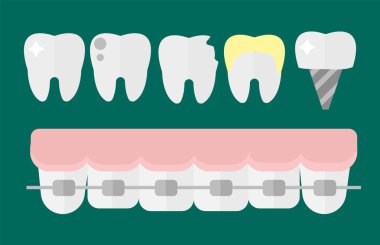 Araştırma tıbbi sağlık kavramı ve tıp enstrüman hijyen stomatology vektör çizim mühendislik düz sağlık diş hekimi diş implantları.