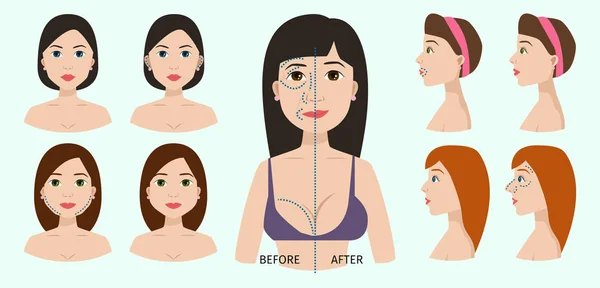 Chirurgie plastique parties du corps femme médecine beauté vecteur — Image vectorielle