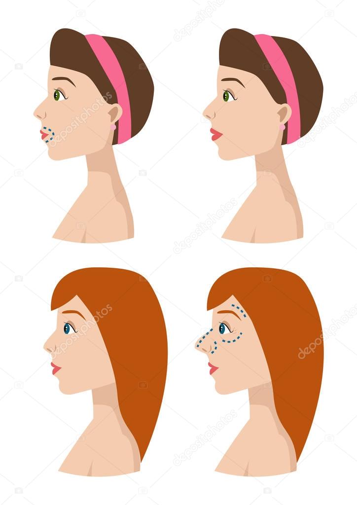 Plastic surgery body parts woman correction anaplasty medicine skin treatment beauty health procedure vector illustration. Human patient medical surgeon person anatomy.