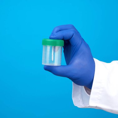 Beyaz önlüklü ve mavi steril lateks eldivenli doktor dışkı analizi için plastik bir kavanoz tutuyor.