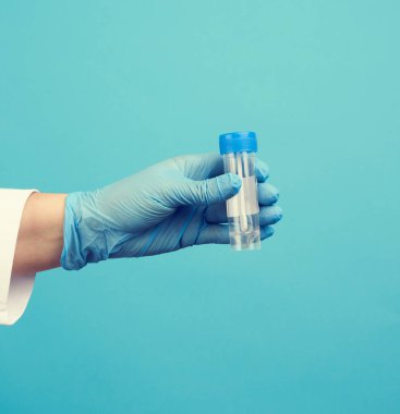 Beyaz önlüklü ve mavi steril lateks eldivenli doktor dışkı analizi için plastik bir kavanoz tutuyor.