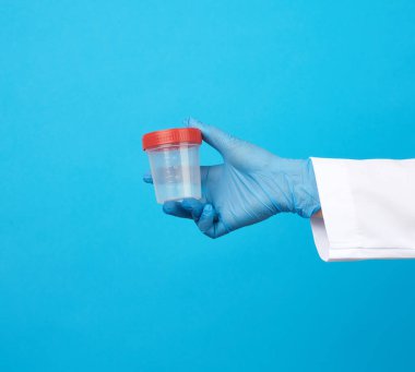 Beyaz önlüklü doktor idrar örneği için boş plastik bir kap tutuyor. Mavi steril tıbbi eldiven giyiyor.