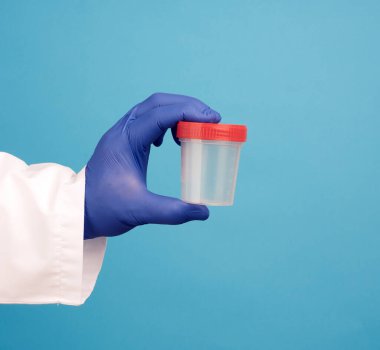 Beyaz önlüklü doktor idrar örneği için boş plastik bir kap tutuyor. Mavi steril tıbbi eldiven giyiyor.