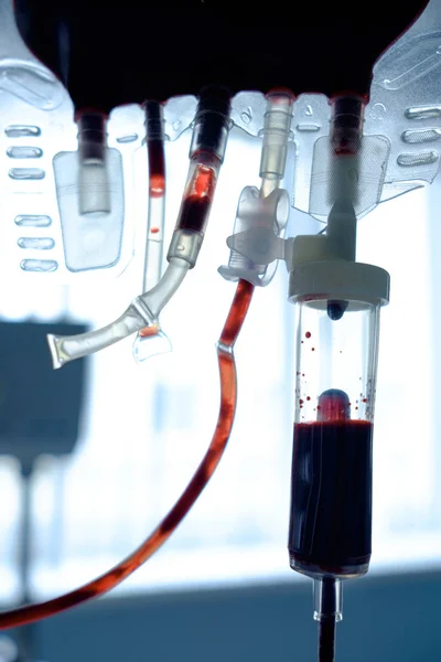 Prepearing a emotrasfusione — Foto Stock