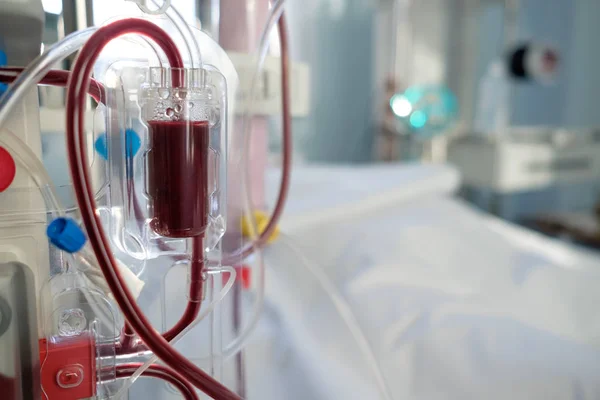 Εντατική φροντίδα έκτακτης ανάγκης δωμάτιο με μηχάνημα αιμοκάθαρσης (ή hemo — Φωτογραφία Αρχείου