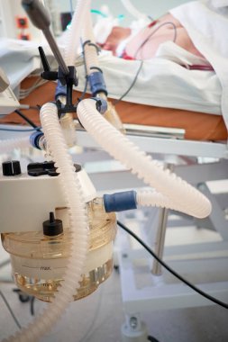 Koronavirüs salgını. Koronavirüs zatürresi olan yakın çekim hastası kritik durumda. Solunum cihazıyla tüp yutturuldu. Yoğun bakımda komada yatıyor..