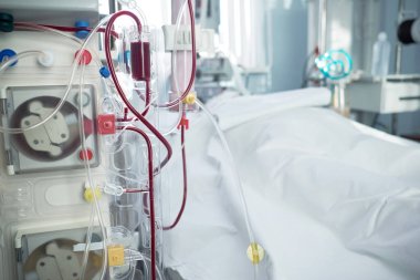 Koronavirüs enfeksiyonu olan hasta kritik durumda. Hemoanaliz makinesi ya da hemofiltrasyon prosedürü olan yoğun bakım acil servisi..
