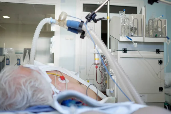 头孢病毒性肺炎患者处于危险状态 在重症监护病房 在呼吸机下插管的老年人在昏迷中躺着 — 图库照片