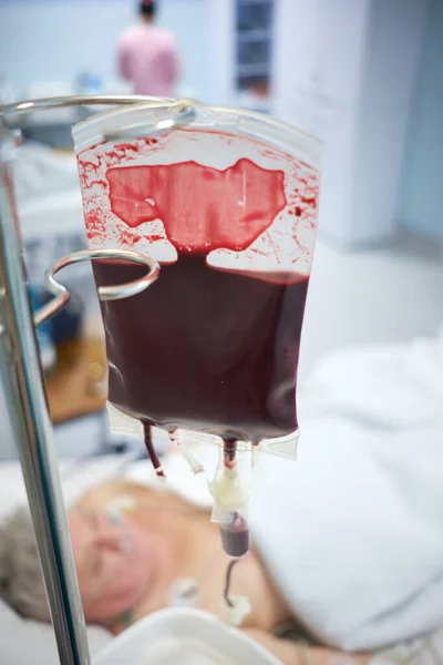 Close Upzicht Van Bloedtransfusie Intensive Care — Stockfoto