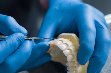 üst çene, diş konsept modellerinin diş alçı tutan el