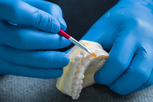Ręka trzyma stomatologicznych gipsowe modele, stomatologiczne koncepcja — Zdjęcie stockowe