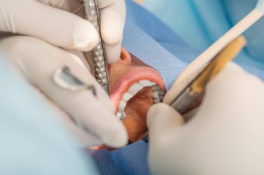 insanlar, ilaç, kavram - stomatology ve diş hekimliği diş tedavisi diş Kliniği olan hasta yüz yakın