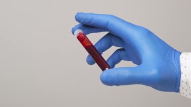 Virüs kan testi. Koruyucu eldivenler giymiş, elinde kanla tüp tutan bir sağlık görevlisi.