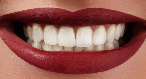 Красива посмішка з відбілюванням зубів. Стоматологічне фото. Ідеальний модний макіяж губ. Здоров'я щаслива жіноча посмішка. Макро крупним планом знімок жіночого рота. Догляд за зубами — стокове фото
