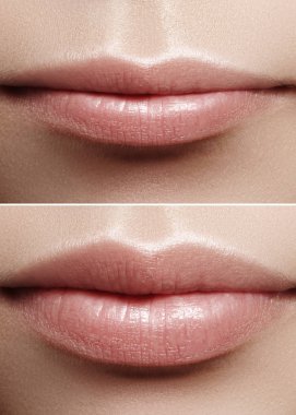 Önce ve sonra dudak dolgu enjeksiyonları. Güzellik plastik. Doğal makyaj ile güzel mükemmel dudaklar. Seksi makro kadın ağızlı. Dolgun dudaklar büyütme. Salon yordamı