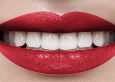 Diş beyazlatma ile güzel gülümseme. Diş fotoğraf. Makro closeup lipscare rutine mükemmel kadın ağız