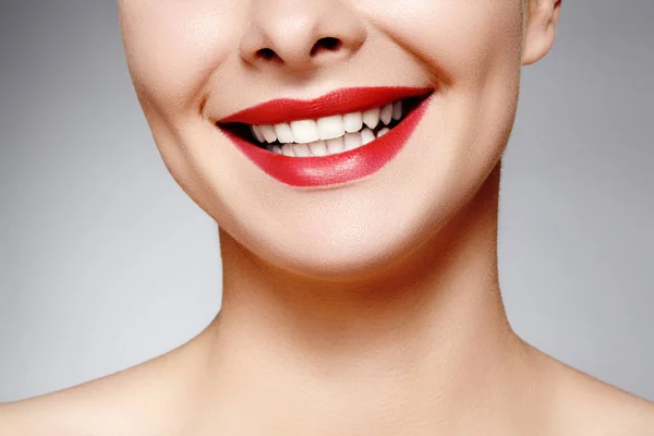 Amplia sonrisa de joven hermosa mujer, dientes blancos sanos perfectos. Blanqueamiento dental, ortodoncia, cuidado dental y bienestar — Foto de Stock