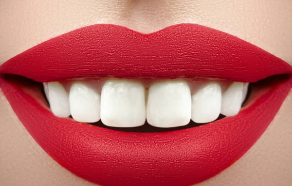 Amplia sonrisa de joven hermosa mujer, dientes blancos sanos perfectos. Blanqueamiento dental, ortodoncia, cuidado dental y bienestar — Foto de Stock