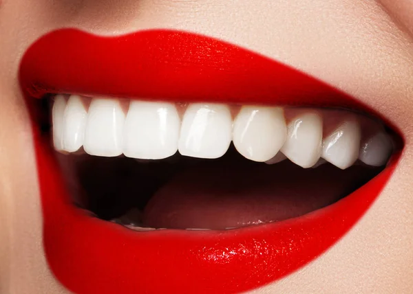 Sonrisa brillante con dientes blanqueadores y labios rojos brillantes. Foto dental. Macro de maquillaje de moda sexy —  Fotos de Stock