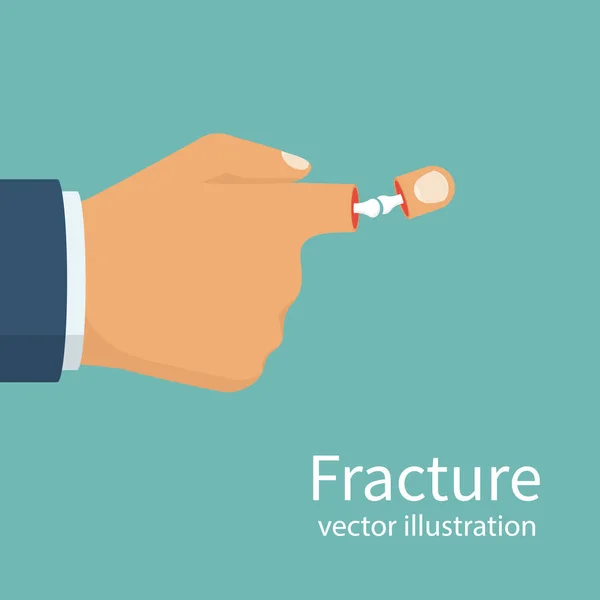 Fractuur hand. Gebroken vinger. — Stockvector