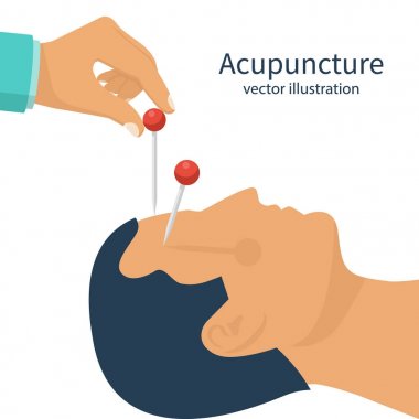 Akupunktur tedavisi portre