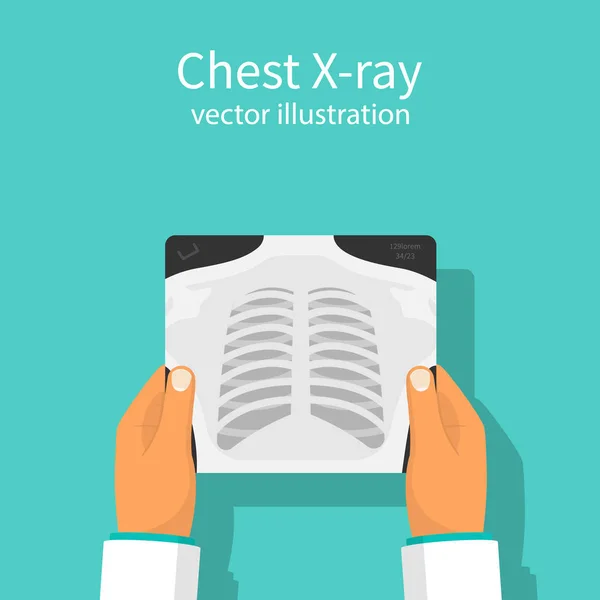 Рентгеновский вектор груди — стоковый вектор