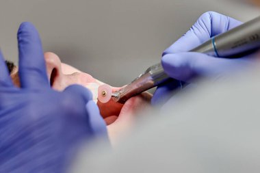 Dişleri cilalamak ve delmek. Yakın plan.