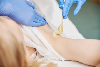 İşlem sallanıyor. Mavi tıp eldivenleri uzmanı müşterinin koltuk altına şeker yapıştırıcısı sür.