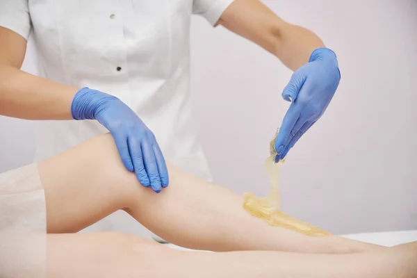 Procedimento Embaralhamento Mestre Luvas Médicas Azuis Remove Pasta Açúcar Com — Fotografia de Stock