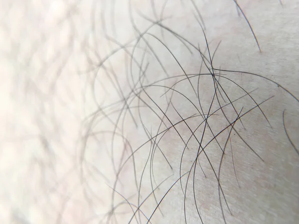 Λεπτομέρεια ανθρώπινου δέρματος με μαλλιά, κοντινό πλάνο, μακροεντολή. — Φωτογραφία Αρχείου