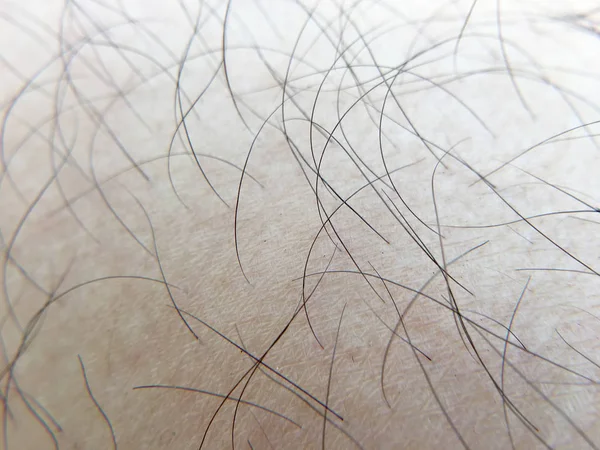 Λεπτομέρεια ανθρώπινου δέρματος με μαλλιά, κοντινό πλάνο, μακροεντολή. — Φωτογραφία Αρχείου