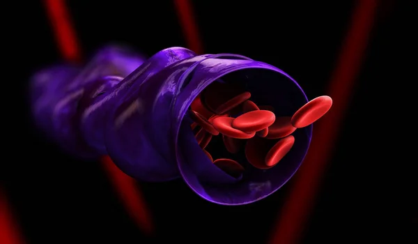 bir bacak, izole siyah 3D resimde varisli damar formlarda