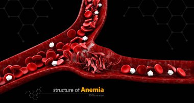 Sickle cell anemia, 3D illustration showing blood vessel with normal and deformed crescent isolated black clipart