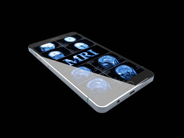Ilustración 3D del concepto de Medicina: Smartphone con texto azul MRI y rayos X del cráneo en pantalla, negro aislado — Foto de Stock