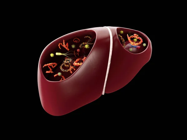 세균 과 바이러스를 이용 한 간 감염 의 3D 렌더링 — 스톡 사진