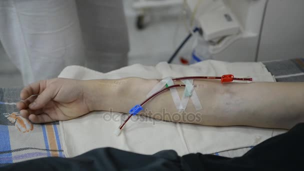 Медсестра готовит руку пациента к диализу — стоковое видео