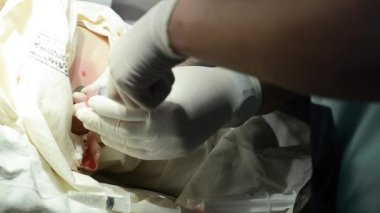 cerrah ameliyat için hasta pnömoni ile yapma