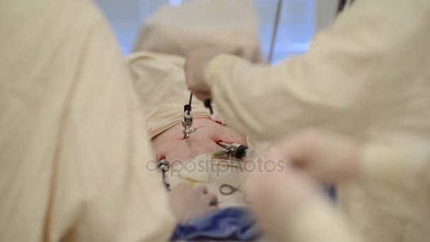 Team surgeon at work in operating room — Stock Video