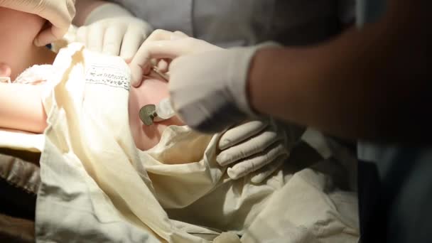 Chirurg, takže zákrok pro pacienta s zápal plic — Stock video