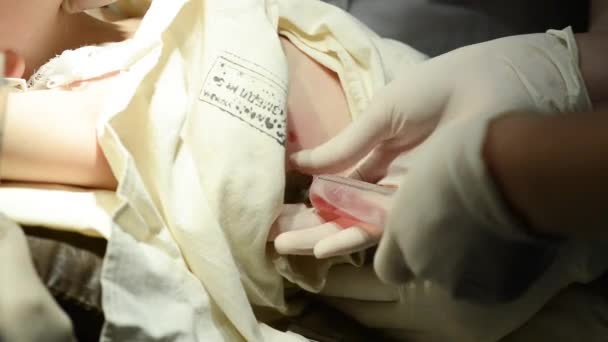 Хірург робить операцію для пацієнта з пневмонією — стокове відео