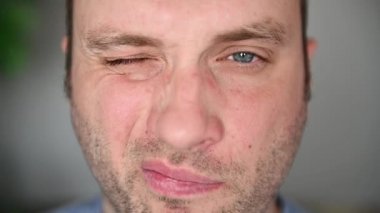 Mavi gözlü, gözlüklü yakışıklı bir adam kameraya bakıyor. Gözlük takar ve gözlerini ovar.